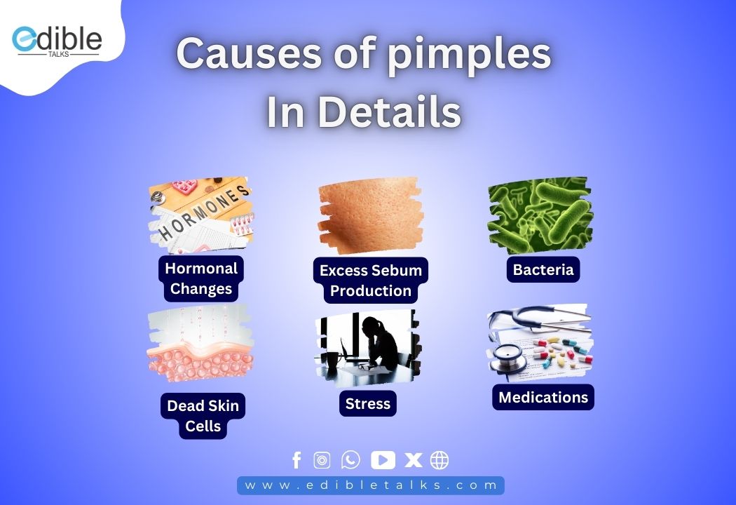 Causes of Pimples edibletalks